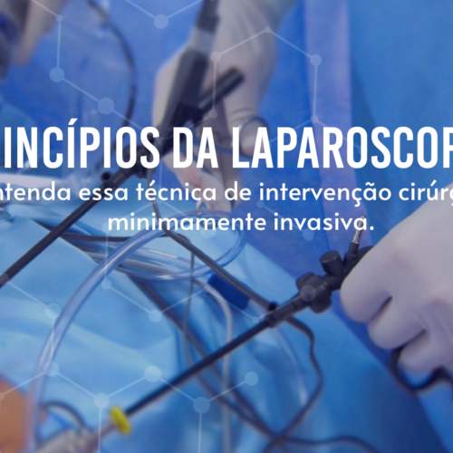 Os princípios da Laparoscopia