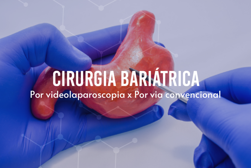 Cirurgia bariátrica por videolaparoscopia x por via convencional